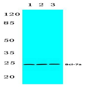 Bcl-7a (N62) pAb