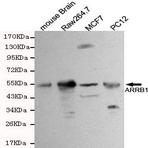 Arrestin-(beta)-1 mAb