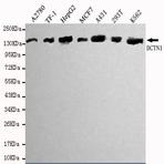 Dynactin 1 (N-terminus) mAb