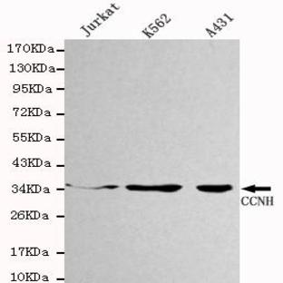 Cyclin H mAb