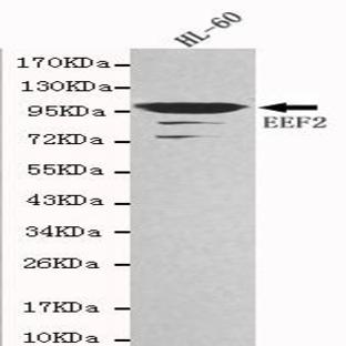 EEF2 mAb