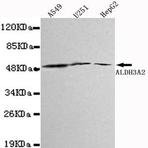 ALDH3A2 mAb