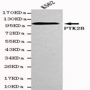 PYK2 mAb