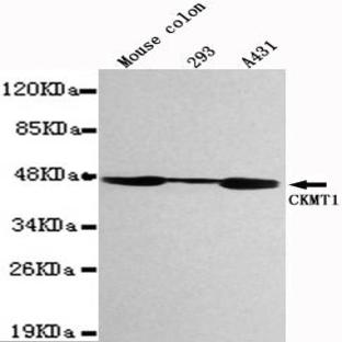 CKMT1 mAb