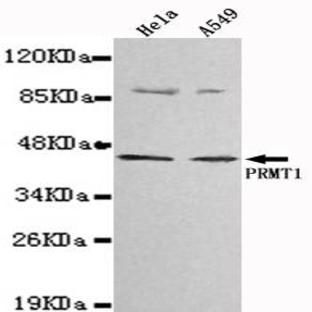 PRMT1 mAb