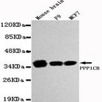 PPP1CB mAb