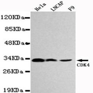 CDK4 mAb