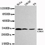 CDK4 mAb