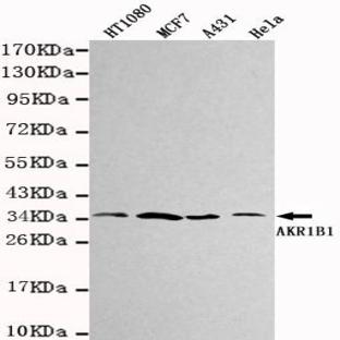 AKR1B1 mAb