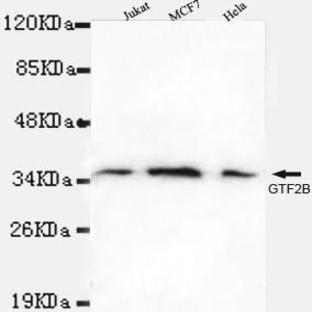 TFIIB mAb