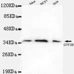 TFIIB mAb