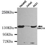 SMC1A (N-terminus) mAb