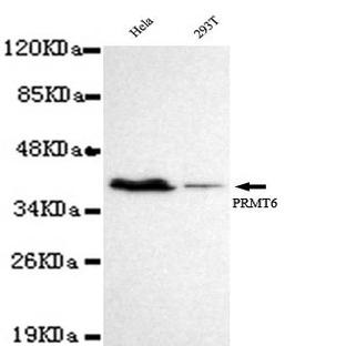 PRMT6 mAb