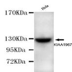 KIAA1967 (N-terminus) mAb