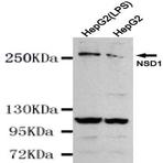 NSD1 / KMT3B mAb