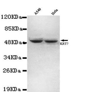 Cytokeratin 7 (N-terminus) mAb