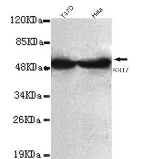 Cytokeratin 7 (C-terminus) mAb