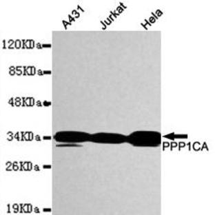  PP1A / PPP1CA (N-terminus) mAb