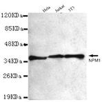 NPM1 mAb