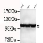 Hexokinase-2 ( N-term) mAb