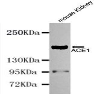 ACE (N-terminus) mAb