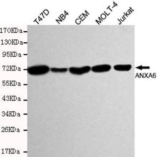 Annexin 6 mAb