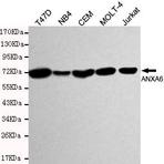 Annexin 6 mAb