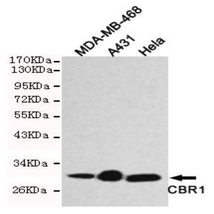 CBR1 mAb