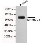 CHRDL1 mAb