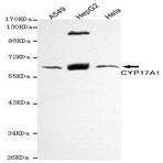 CYP17A1 mAb