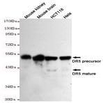 TNFRSF10B / DR5 mAb 