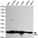 HSP27 mAb