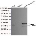 IL18BP mAb