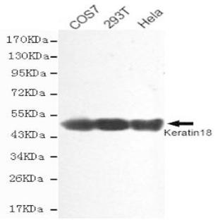 Cytokeratin 18 mAb