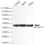 Cytokeratin 18 mAb