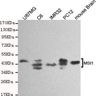 Musashi-1 mAb