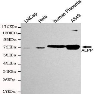 ALPP mAb