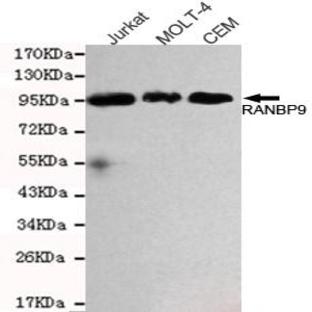 RanBP9 mAb