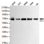 RPA1 mAb