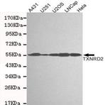 TXNRD2 mAb