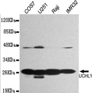 UCHL1 mAb