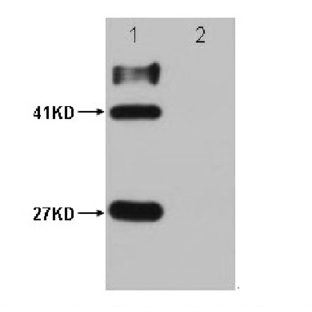 HSV-Tag Mouse mAb