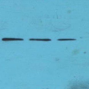 Histone H3 (Tri-Methyl K4) mAb