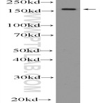EPRS Antibody - glutamyl-prolyl-tRNA synthetase