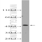 ZNF557 Antibody - zinc finger protein 557