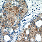 THRSP Antibody - thyroid hormone responsive (SPOT14 homolog, rat)