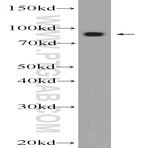 VPS35 Antibody - vacuolar protein sorting 35 homolog (S. cerevisiae)