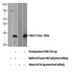 NME6 Antibody - non-metastatic cells 6, protein expressed in (nucleoside-diphosphate kinase)