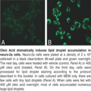 Lipid Droplets Fluorescence Assay Kit