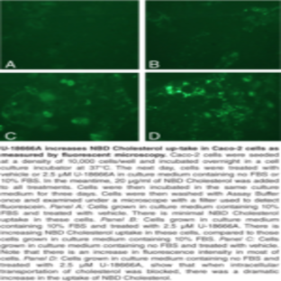 Cholesterol Uptake Cell-Based Assay Kit